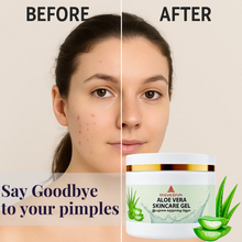 Load image into Gallery viewer, HERBAL ALOEVERA GEL Pack of 1 / ஹெர்பல் கற்றாழை ஜெல் ( 100g ) - MAVASIVA