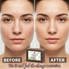 Load image into Gallery viewer, Before and after comparison of a woman's face with a Mavasiva soap bar in the center.